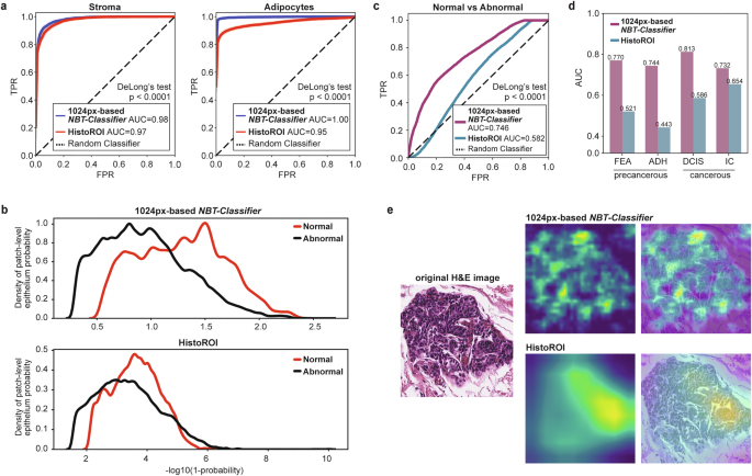 Fig. 3: NBT-Classifiers capture features unique to normal breast epithelium.