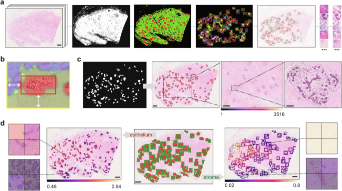 Fig. 5: Approaches facilitating downstream WSI analysis of NBTs.