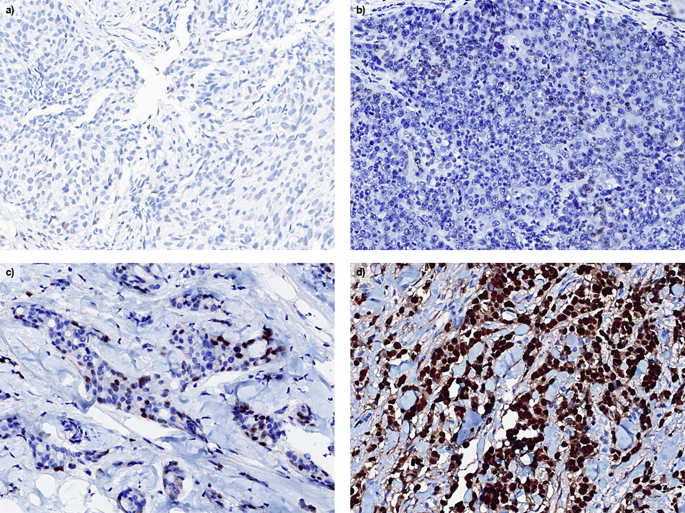 Fig. 1: Representative examples of four ER categories.