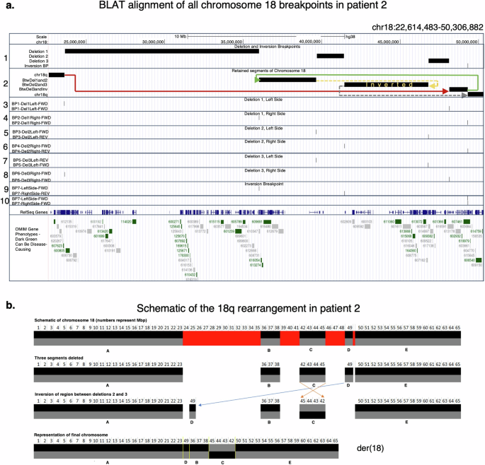 Fig. 4: Long breakpoint-spanning reads unraveled a complex chromosome 18q rearrangement in family 2.