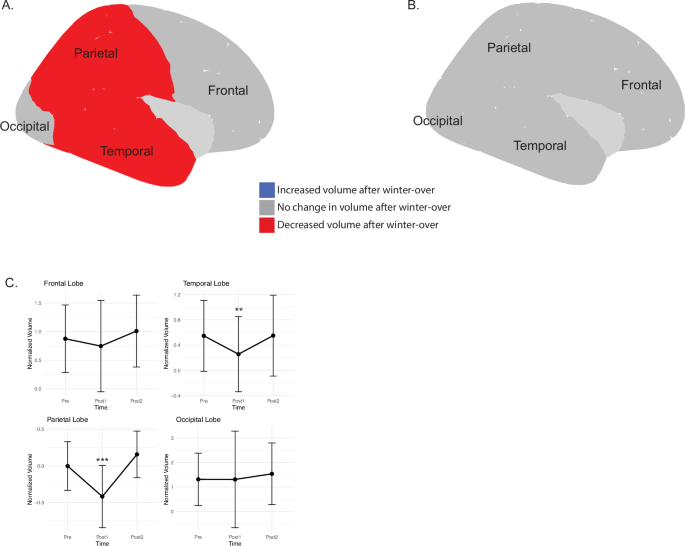Fig. 1: Crewmembers show a transient decrease in gray matter volume in some cortical brain regions after a winter-over at the Concordia station.