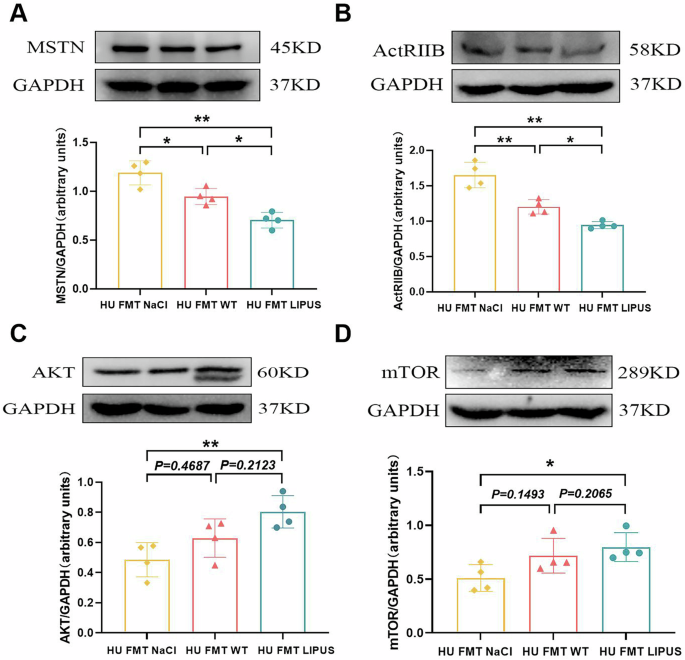 Fig. 8: The effect of fecal microbiota transplantation from abdominal LIPUS treated mice on the MSTN/AKT/mTOR signaling pathway in hindlimb unloaded mice.