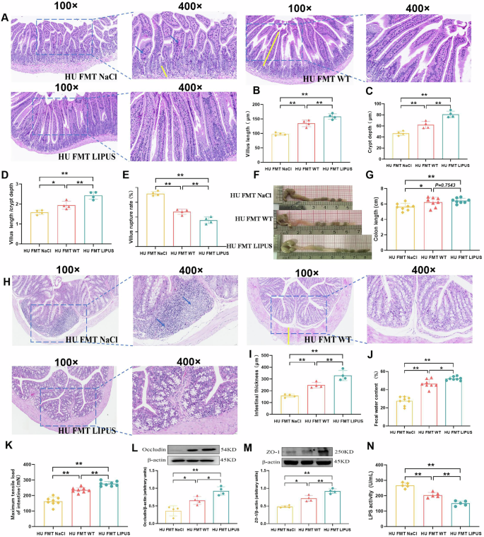 Fig. 9: The effect of fecal microbiota transplantation from abdominal LIPUS treated mice on intestinal barrier and function in hindlimb unloaded mice.