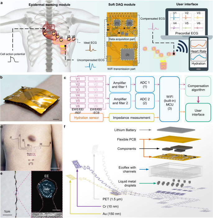 Chest-scale self-compensated epidermal electronics for standard  6-precordial-lead ECG | npj Flexible Electronics