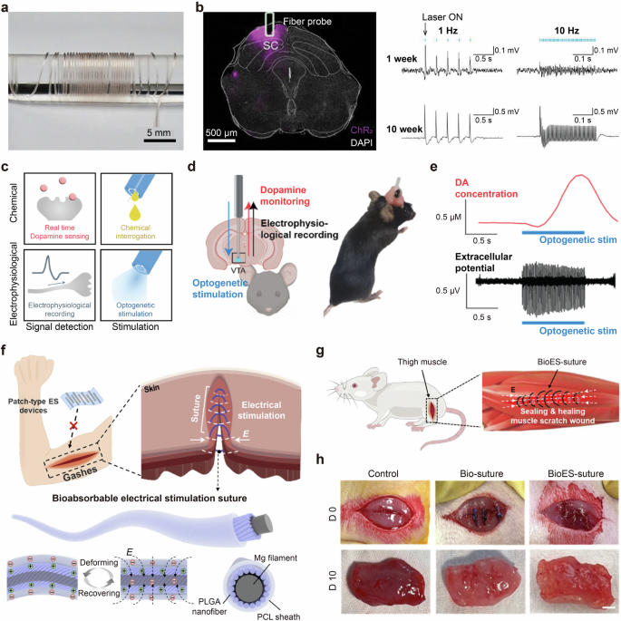 Fig. 15: Therapeutic stimulation.