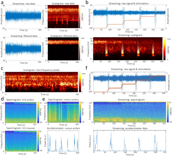 Fig. 4: Case study of in-clinic recordings.