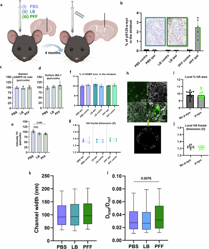 Fig. 2: Influence of α-synuclein pathology on the striatal ECS.