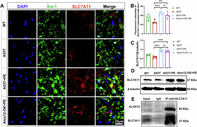 Fig. 8: Expression of SLC7A11 and interaction with ALOX12 as determined by histological staining, western blotting, and CO-IP.