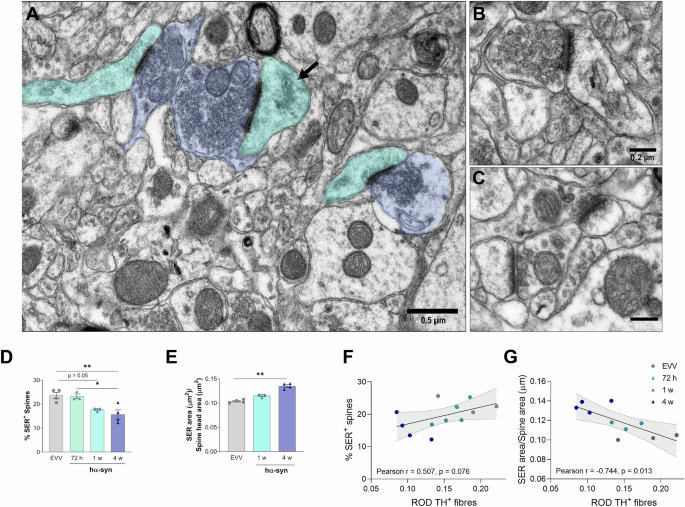 Fig. 4: Progressive ultrastructural changes in the SER inside dendritic spines of SPNs.
