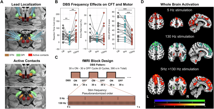 Fig. 5: Effects of different frequency DBS-STN stimulation on behavioral and motor response and BOLD signal (Experiment 3).