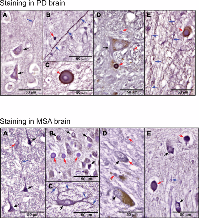 Fig. 2: Staining of human brain tissue.