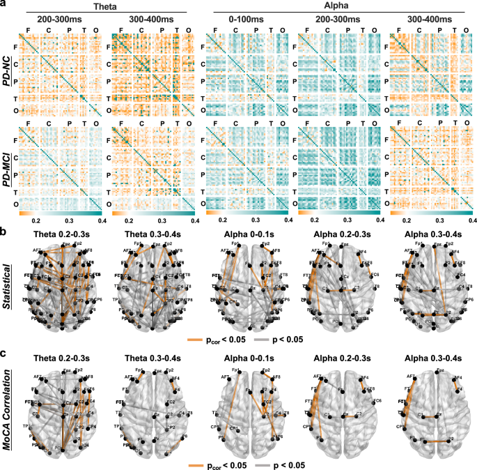 Fig. 4: Cortical connectivity analysis elicited by TMS of the right PPC and MoCA correlations.