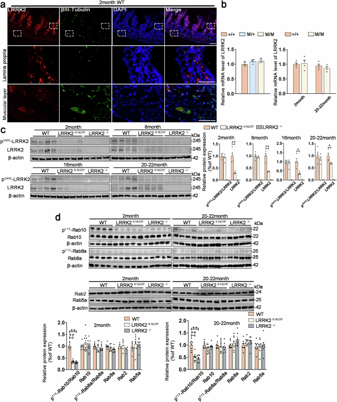 Fig. 1: Expression of LRRK2 in the rat small intestine.