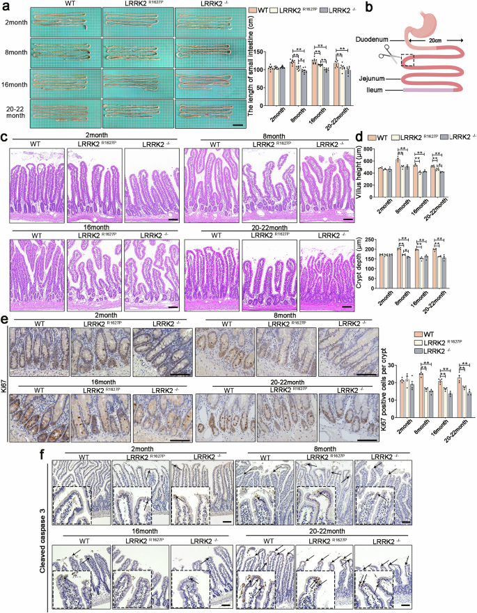 Fig. 2: Intestinal pathological phenotypes of WT, LRRK2R1627P and LRRK2−/− rats at different ages.