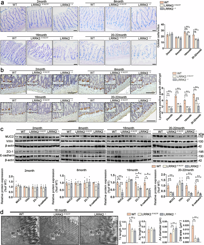 Fig. 3: Differentiation and intercellular junctions of small intestinal epithelial cells in rats at different ages.