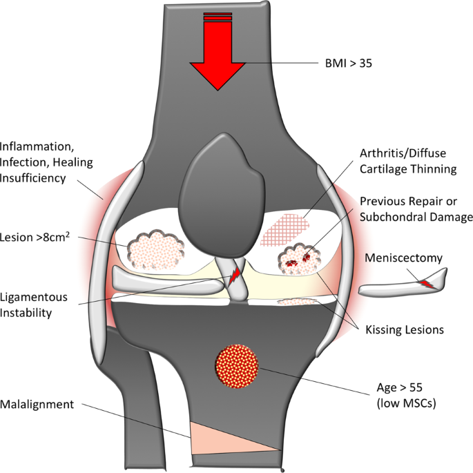 repair knee cartilage naturally