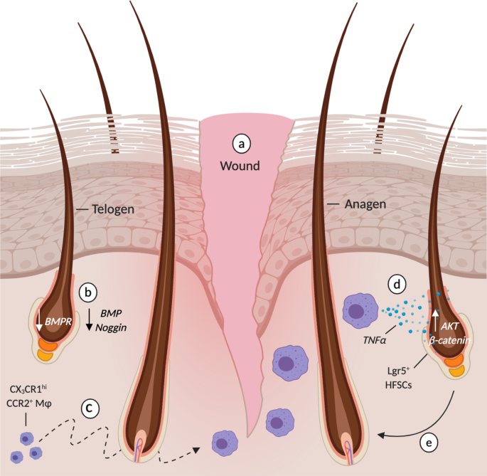 Immune modulation of hair follicle regeneration | npj Regenerative Medicine