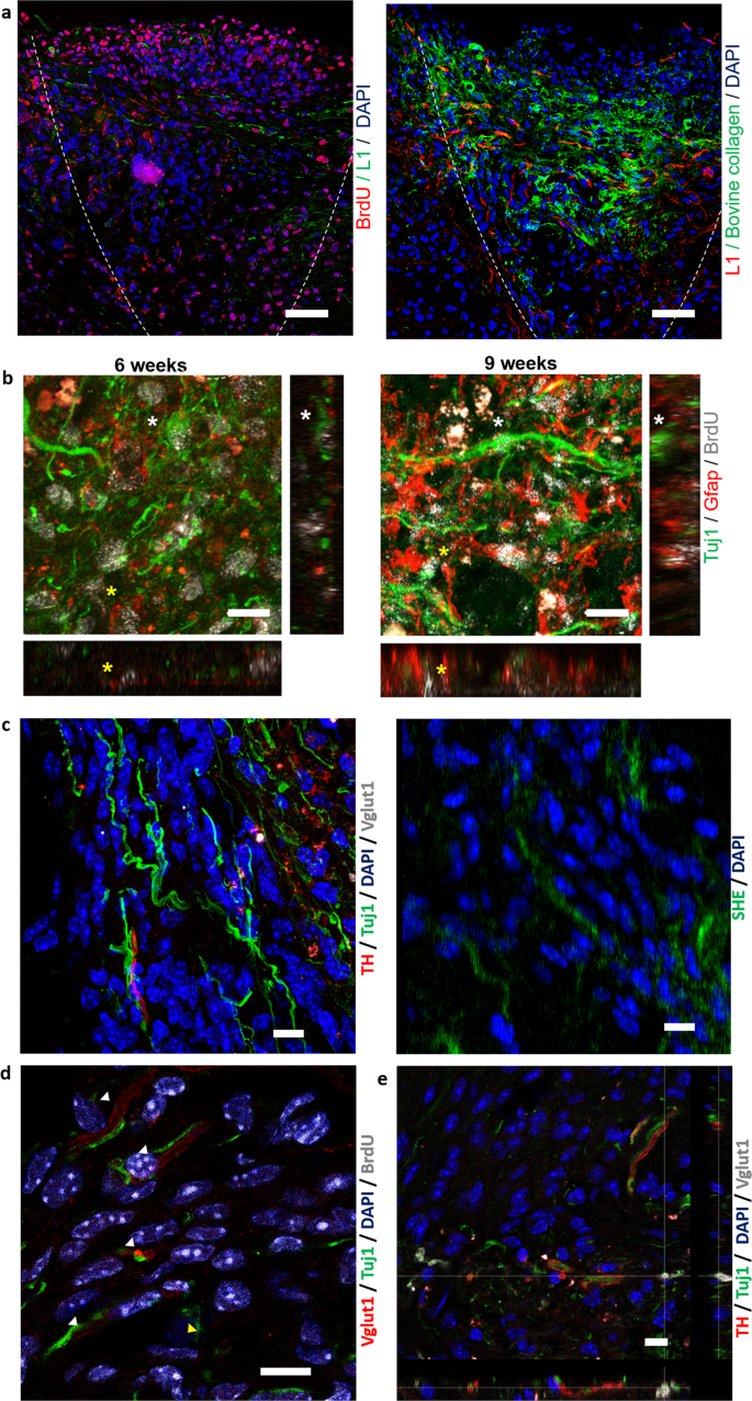 Neural stem cell delivery via porous collagen scaffolds promotes neuronal  differentiation and locomotion recovery in spinal cord injury | npj  Regenerative Medicine