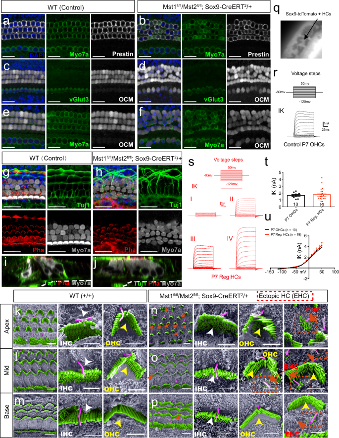 Fig. 4: The supernumerary HCs induced by YAP nuclear translocation are functional but immature in vivo.