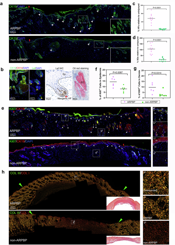 Fig. 5: ARPBP promotes regenerative wound healing in rats.