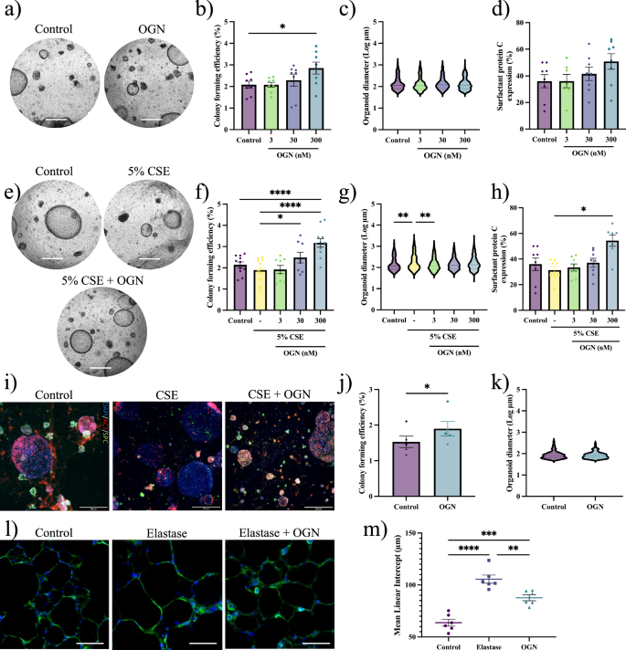 Fig. 4: Osteoglycin supports alveolar organoid formation.