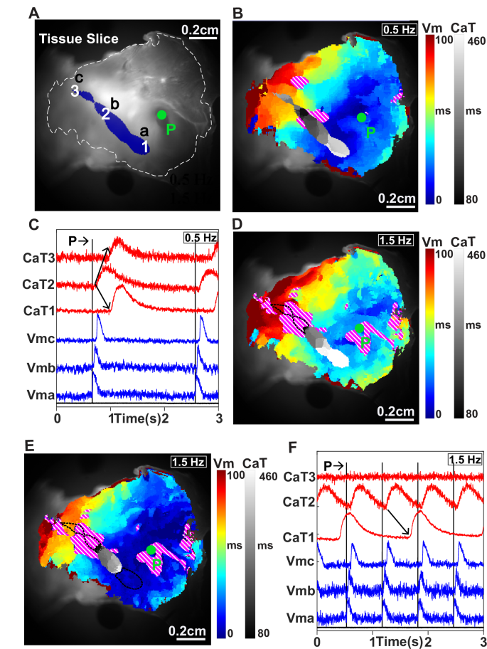 Fig. 1: Electrical activation in the tissue slice with a large, elongated graft.