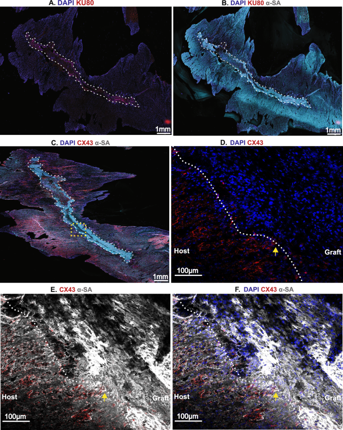 Fig. 2: Immunohistological imaging of the large, elongated graft implanted by parallel injection.