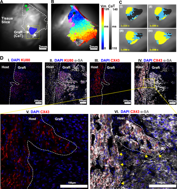 Fig. 3: Electrical coupling between host and graft at two sites.