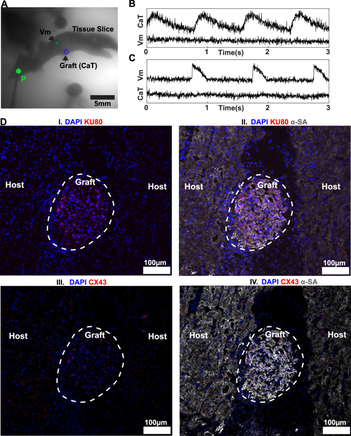 Fig. 4: Graft automaticity.