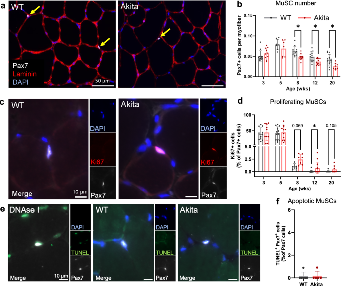 Fig. 2: Diabetes causes reduced muscle stem cell number and disruption of quiescence.