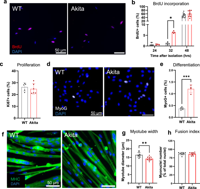 Fig. 3: Muscle stem cells isolated from Akita mice exhibit early activation and differentiation.