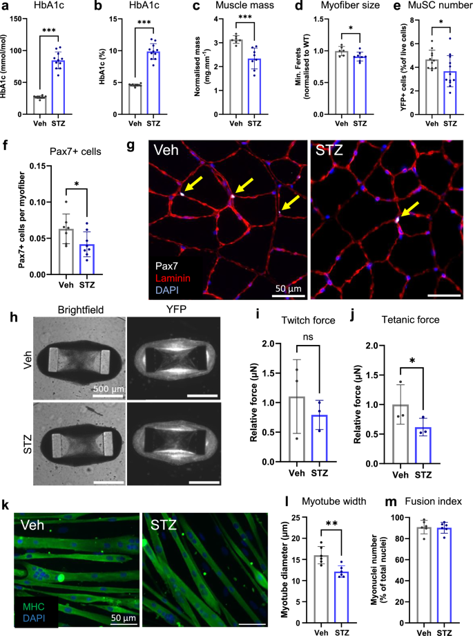Fig. 5: STZ mice exhibit MuSC dysfunction.