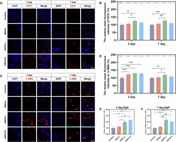 Fig. 10: Angiogenesis and myofibroblast activation in wound tissues.
