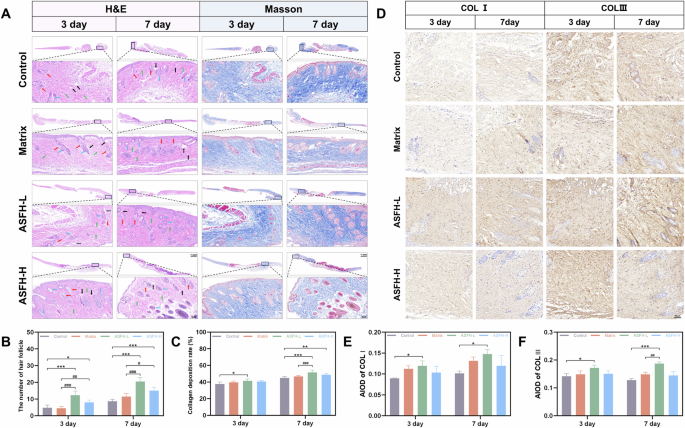 Fig. 7: Histological evaluation of re-epithelialization and collagen remodeling.