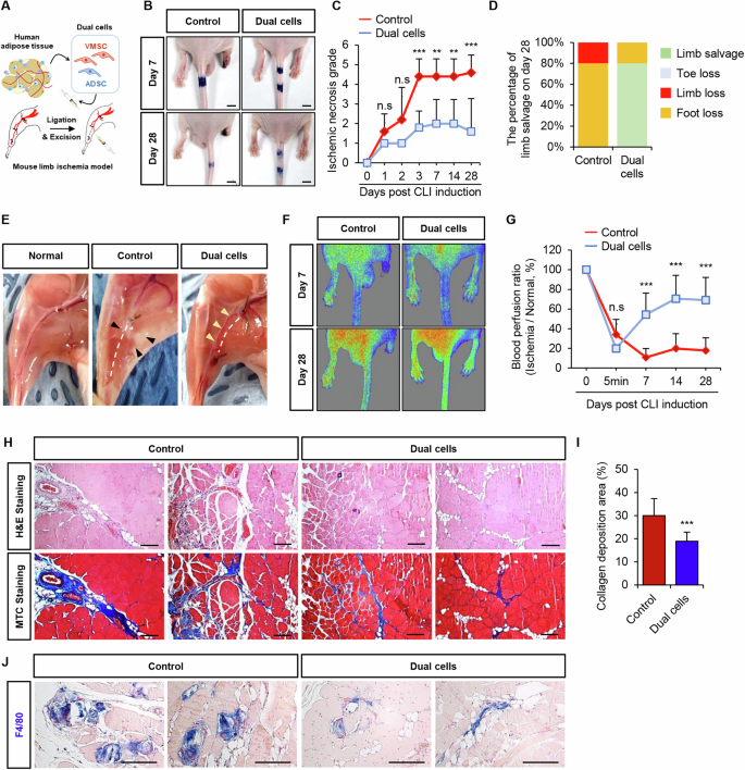 Fig. 4: Dual cell transplantation preserves limb viability in a CLI mouse model by enhancing blood flow restoration and attenuating fibrosis.