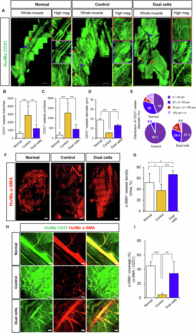 Fig. 6: Whole-mount analysis of vascular density and quality in CLI mice treated with dual cells.