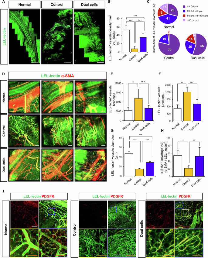 Fig. 7: Dual cell therapy promotes vascular network regeneration by supporting the formation of perfusable vessels.