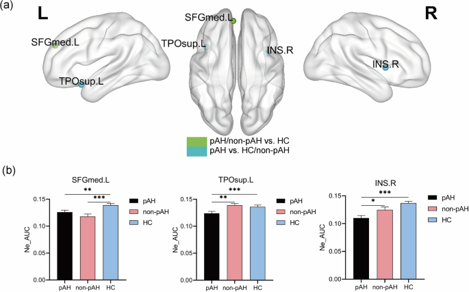 Fig. 1: One-way ANCOVA of the AUC for nodal efficiency.