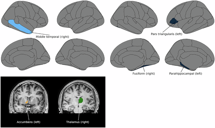 Fig. 3: Toxoplasma gondii and brain structure.