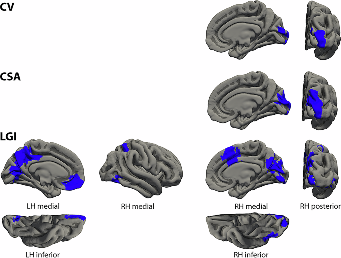 Fig. 3: Clusters of different cortical morphological measures associated with the negative formal thought disorder dimension.