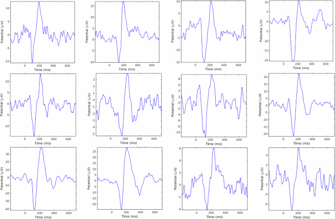 Fig. 2: Shows example AEPs in SCZspect.
