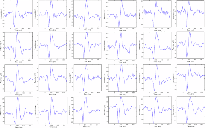 Fig. 3: Shows example AEPs in HC.