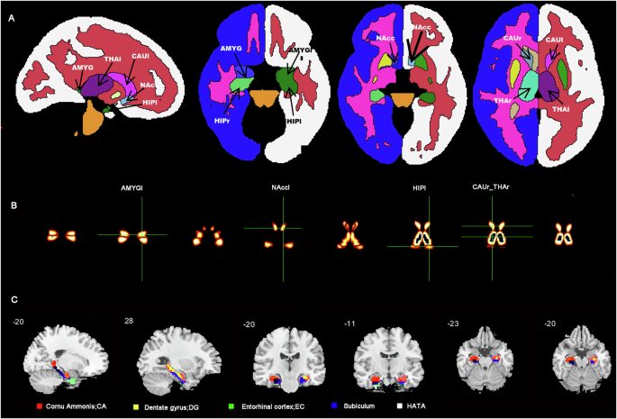 Fig. 1: Regions of interest (ROIs) in the hippocampal-thalamocortical circuitry.
