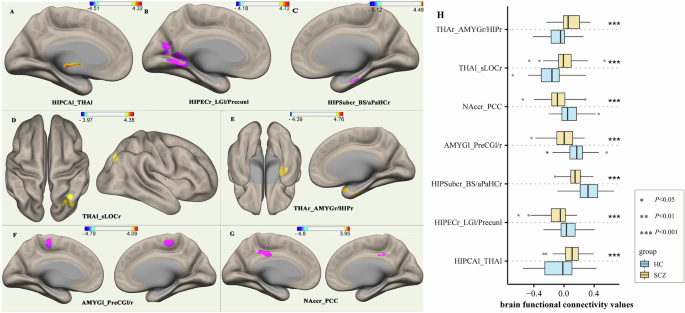 Fig. 2: Aberrant seed-based whole-brain FC patterns in SCZ.