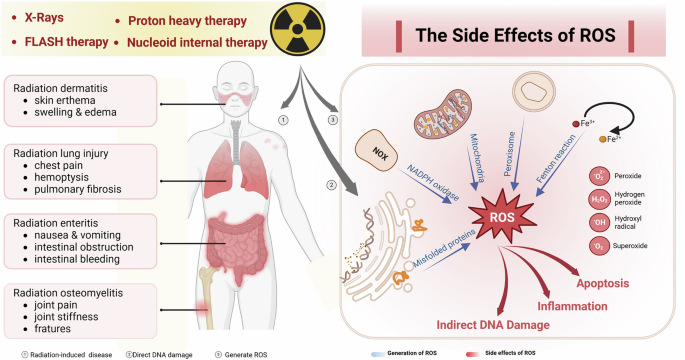 Fig. 2: Left: Comparative analysis of radiotherapy modalities and radio-inflammation pathogenesis.