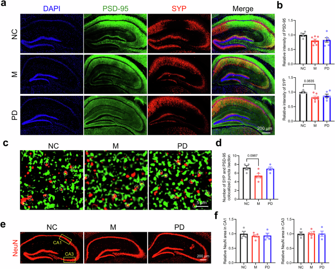Fig. 6: Effects of P. distasonis on neuronal functions in HFD-induced IR mice.