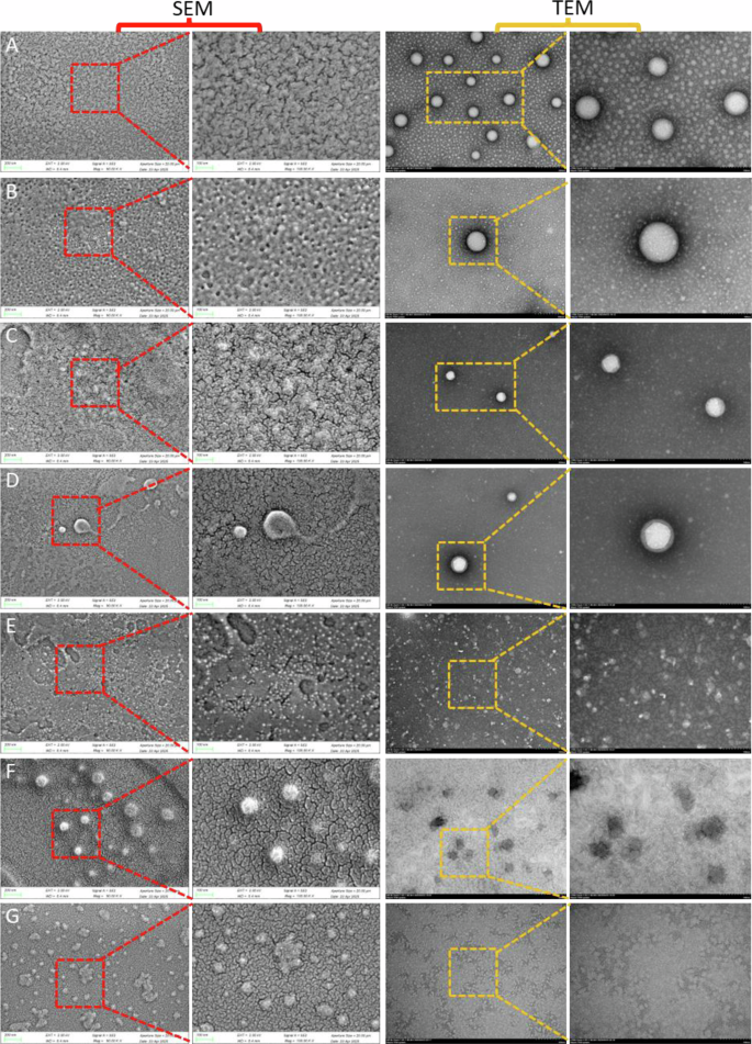 Fig. 7: Analysis of morphological properties of MFGM proteins (1 mg/mL) using an electron microscope.