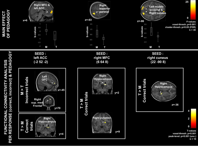 An Fmri Study Of Error Monitoring In Montessori And Traditionally Schooled Children Npj Science Of Learning An Fmri Study Of Error Monitoring In Montessori And Traditionally Schooled Children Npj Science Of Learning