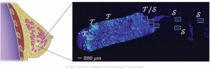 Fig. 2: Data acquisition.