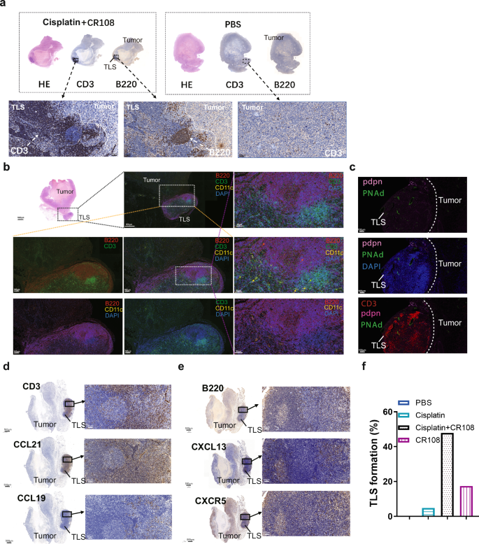 Fig. 2: Effects of cisplatin + CR108 combo therapy on the formation of TLS.